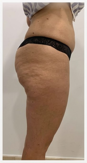 Rocio, 35                                                        Galicia