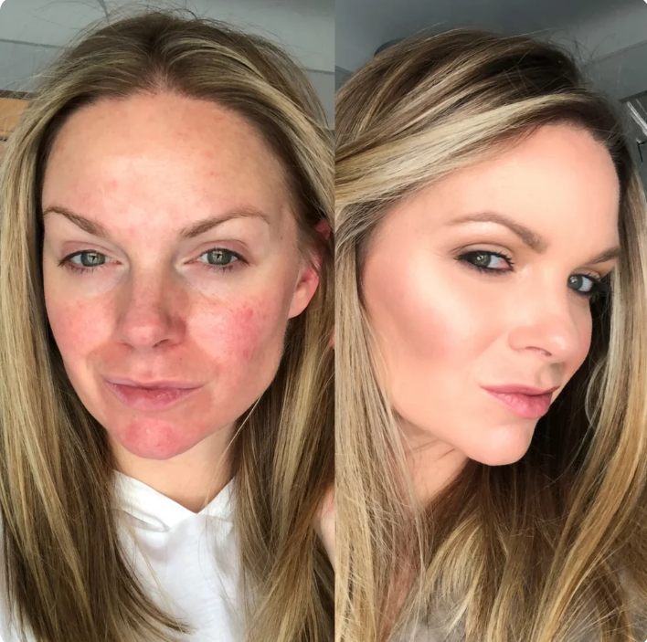 Nivora Smart Base™ Premium 4 en 1