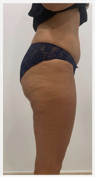 Rocio, 35                                                        Galicia